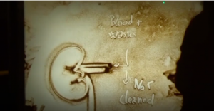 ISN Community Film Finalist - Pre-dialysis Education Value